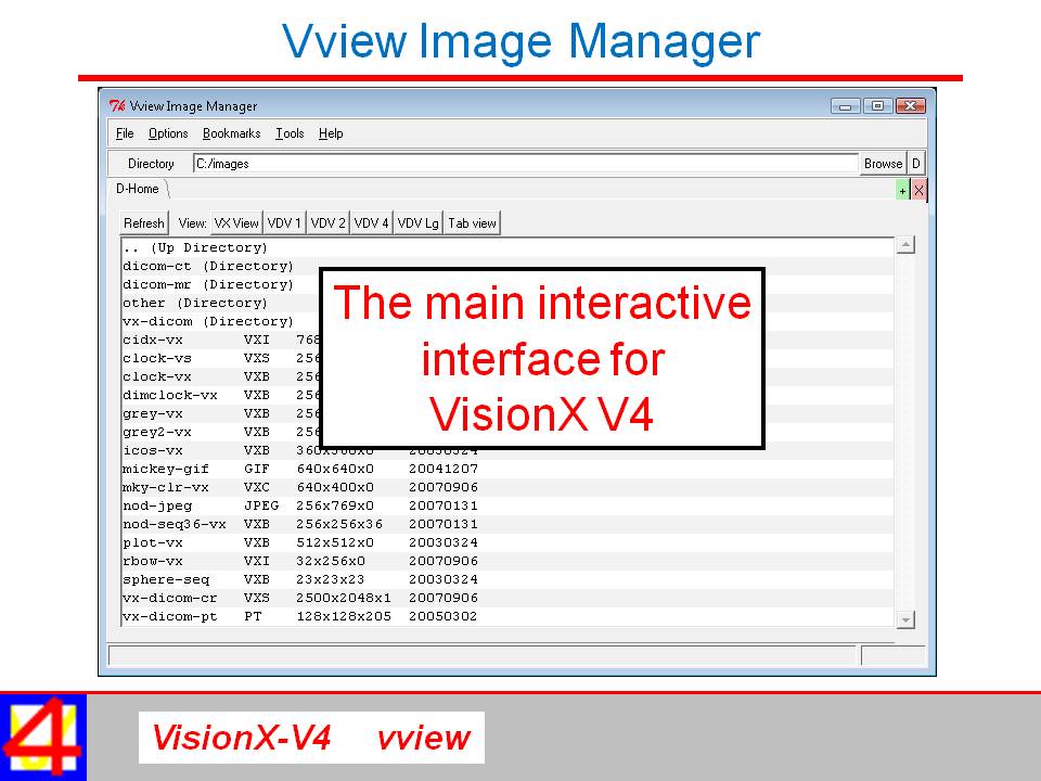 SIMBA Present - vview VisionX Image Manager